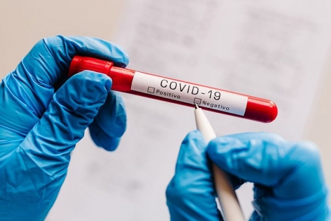 At o momento, 624.664 testes para diagnstico da Covid-19 j foram realizados. (Foto: Reproduo)