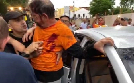 O senador Cid Gomes (PDT) foi baleado nesta quarta-feira (19) em meio a uma confuso na cidade de Sobral, no Cear. O caso ocorreu enquanto ele tentava passar com uma retroescavadeira em meio a um protesto de policiais militares