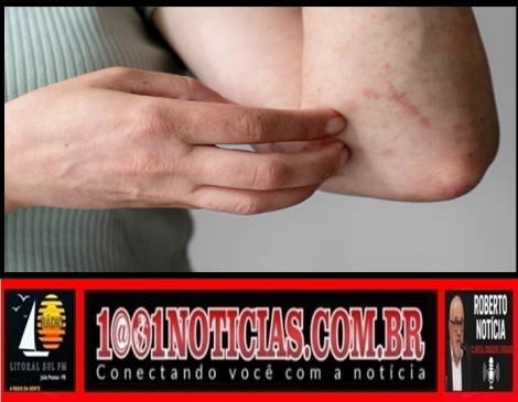 Foto Reprodu��o - Montagem: Sistema 1001 Not�cias de Comunica��o 