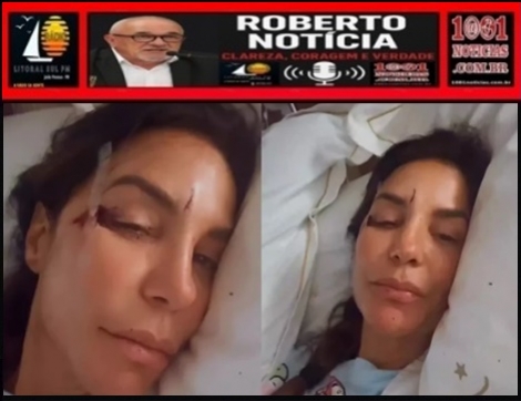 Ivete Sangalo � internada ao sofrer desmaio e bater a cabe�a